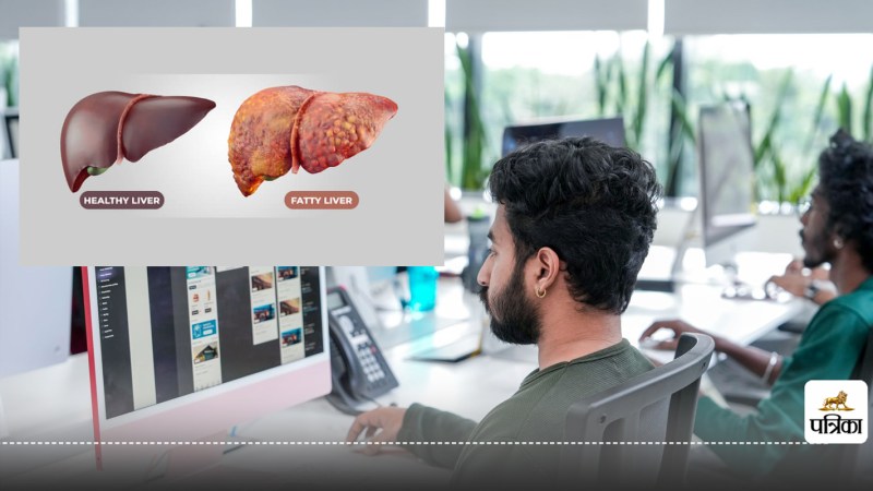 Rising Fatty Liver Risk Among IT Employees Shocking UoH Study