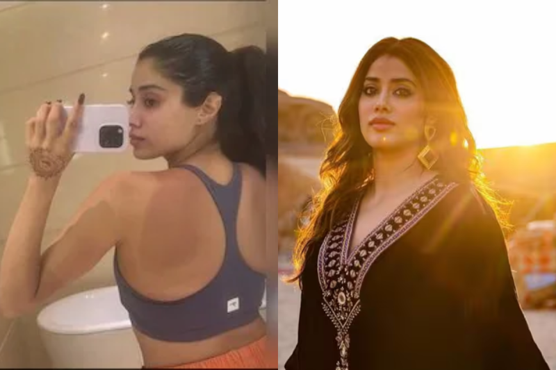 Jhanvi Kapoor Sunburn