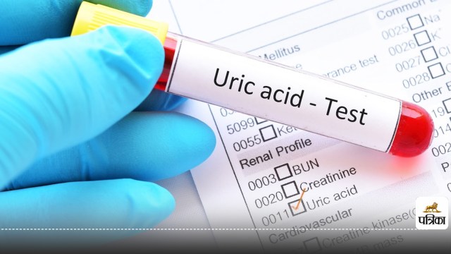 Low uric acid symptoms