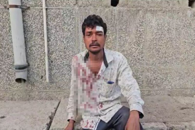 Beaten and loot: 2 बदमाशों ने दिन-दहाड़े पिकअप चालक को बेदम पीटा, फिर सिर फोडक़र लूट लिए 42 हजार रुपए