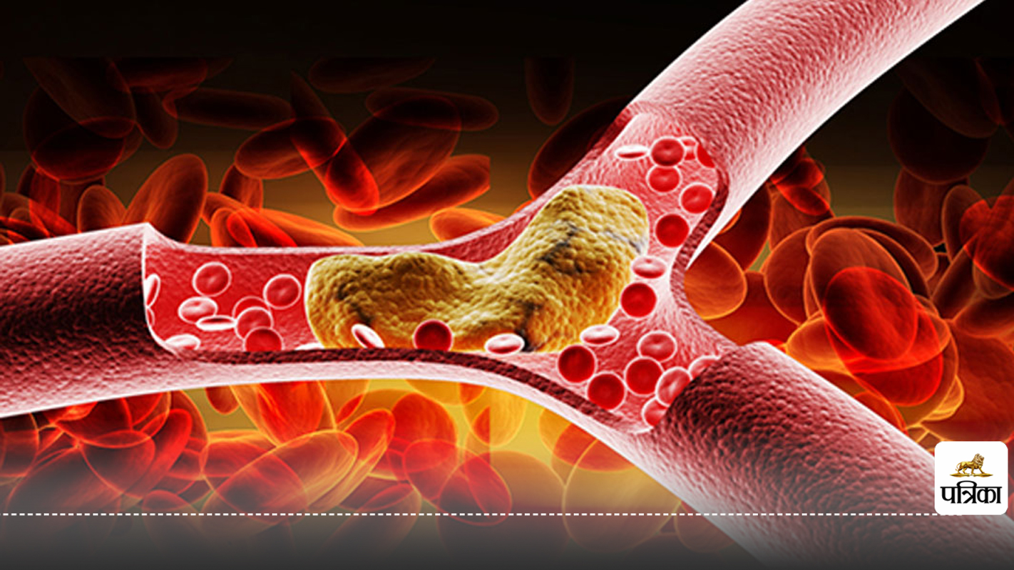 Big causes of bad cholesterol: शरीर में गंदा कोलेस्ट्रॉल बढ़ने से कैसे रोके ,
जानिए 4 आसान उपाय