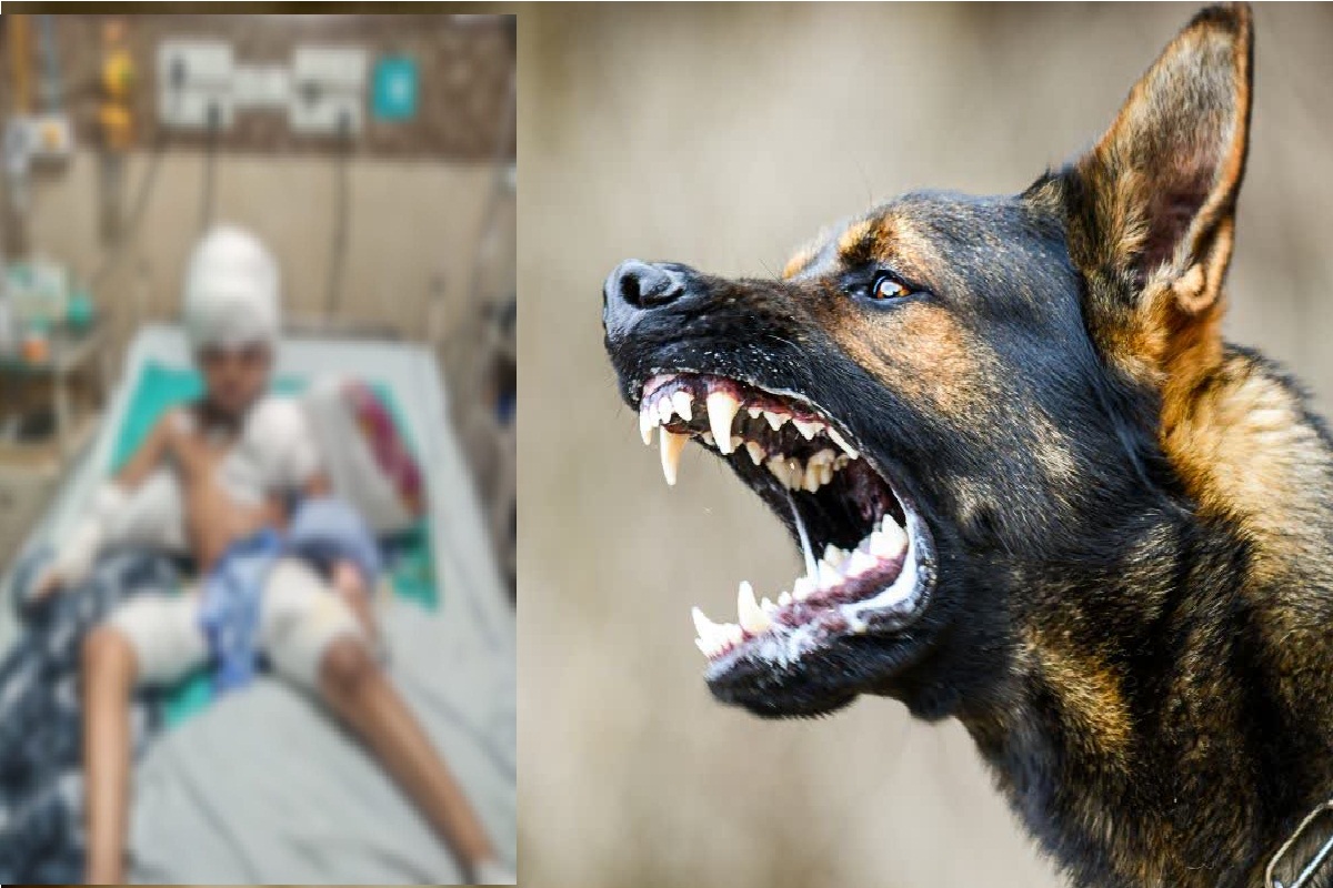 Dog Bite in CG: मासूम बच्चे पर खूंखार कुत्ते का हमला! सिर का मांस नोंचकर खा गए,
पूरे शरीर पर गड़ा दिए दांत..