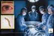 Bhopal AIIMS: Doctors remove live one-inch worm from man’s eye in rare surgery!