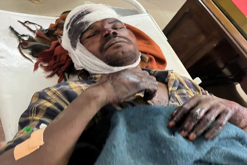 Bears attack: 3 भालुओं ने युवक पर किया हमला, 2 को पटका तो भाग निकले, तीसरे ने गंभीर रूप से किया जख्मी