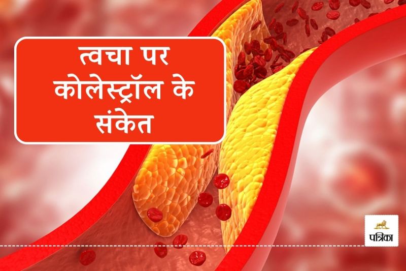 High cholesterol symptoms on skin