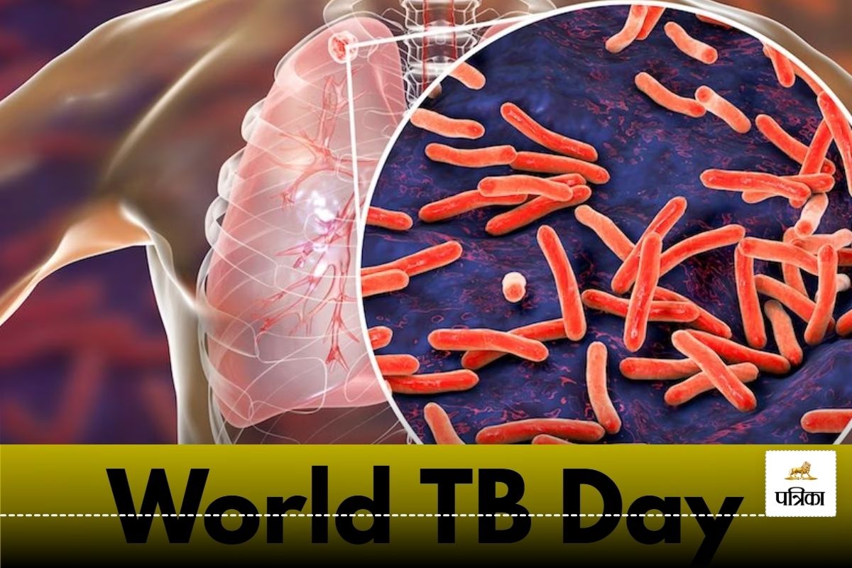 World TB Day: 7 सालों में टीबी से 47 लोगों की गई जान, जानें कैसे मिलेगा इस बीमारी से मुक्ति..