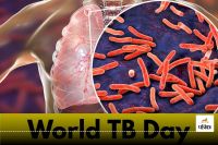 World TB Day: 7 सालों में टीबी से 47 लोगों की गई जान, जानें कैसे मिलेगा इस बीमारी से मुक्ति..