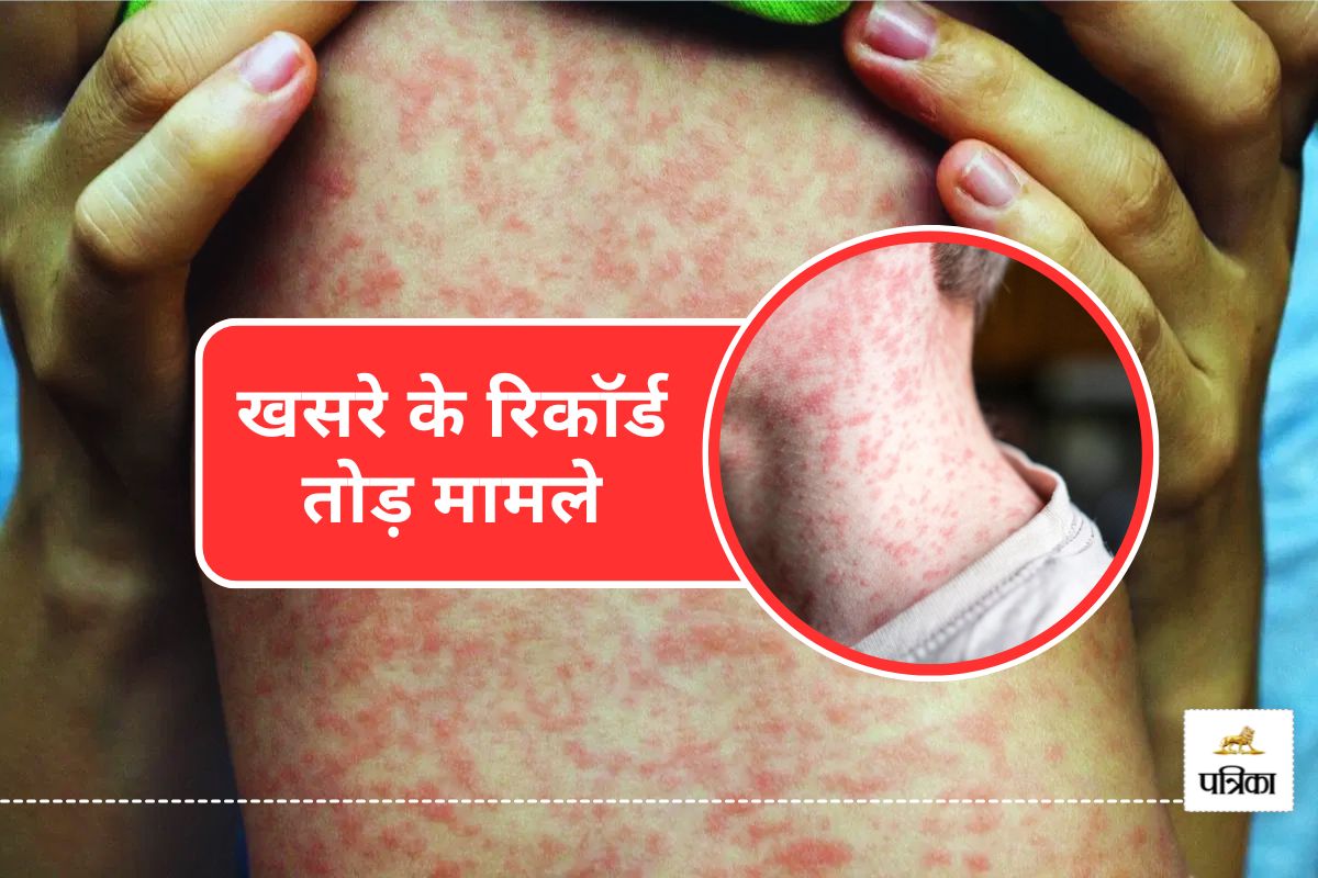 Measles Outbreak Since 1997 in Europe’ Measles vaccine WHO Sounds Alarm