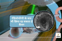 इलाज के बाद भी लौट सकता है Cancer, जानिए क्या करना चाहिए? - image