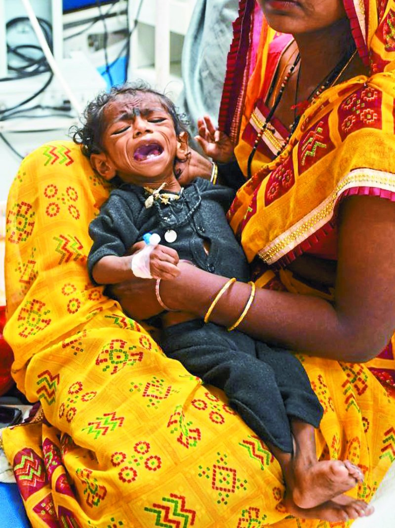 ग्रामीण के साथ शहरी इलाके में भी चपेट में आ रहे बच्चे