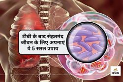 TB treatment : टीबी से जंग जीतने के बाद भी बरतें ये 5 एहतियात, वरना बढ़ सकता है
खतरा! - image