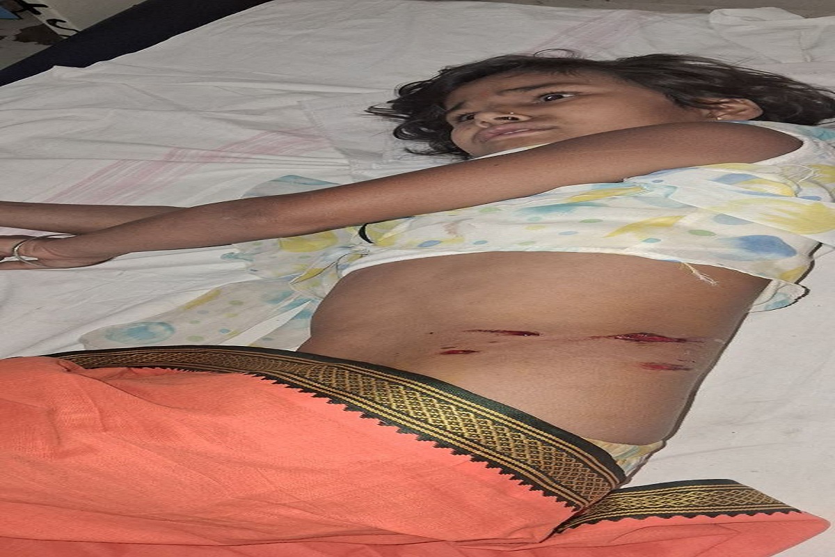 Big news: कुत्तों ने बच्चों को नोंचा, नपा के व्यवस्था पर सवाल