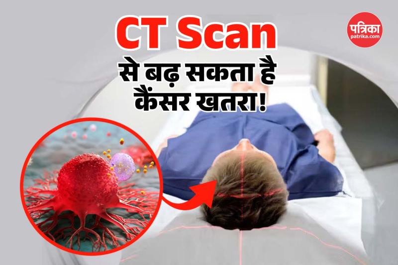 CT Scan Cause Cancer