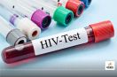 HIV Test