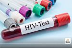 HIV Test
