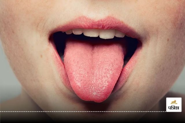 Healthy Tongue Color