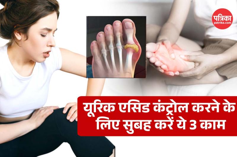 How to reduce Uric Acid
