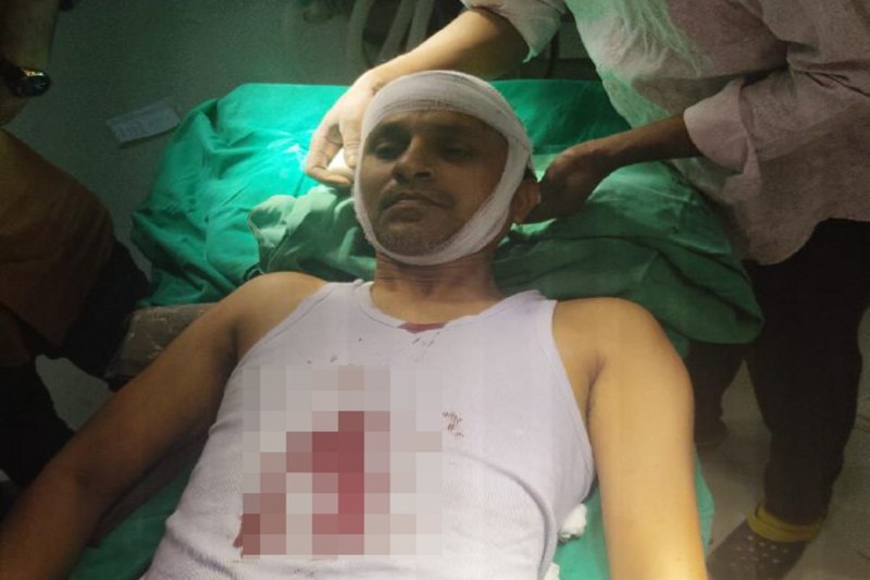 Attack on doctor: डॉक्टर की कार रुकवाकर 3 बदमाशों ने शराब के लिए मांगे पैसे, मना करने पर ईंट से फोड़ा सिर, तोड़ी कांच