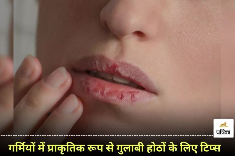 How to keep lips soft and pink in summer