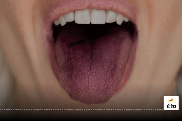 Purple Tongue