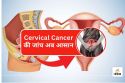 Cervical Cancer की जांच अब आसान, एम्स ने बनाया खास ब्लड टेस्ट