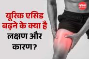 Uric Acid Symptoms