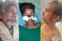 माउंट आबू में तीन लोगों पर एक साथ चार भालुओं का हमला, नाक, मुंह और जबड़ा बुरी
तरह नोंचा; दहशत में आए लोग - image