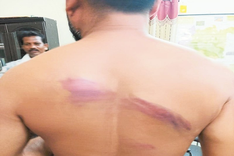 सचिव व तकनीकी सहायक के साथ मारपीट (Photo source- Patrika)