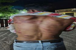 साले की शादी से वापस लौट रहे युवक की बदमाशों ने की मारपीट - image