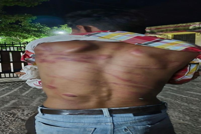 साले की शादी से वापस लौट रहे युवक की बदमाशों ने की मारपीट Miscreants beat up a young man returning from his brother-in-law's wedding