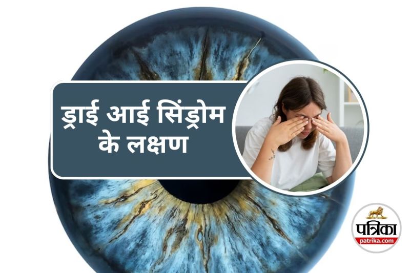 DRY EYE SYNDROME