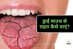 Dry Mouth : मुंह सूखने की समस्या से पाएं छुटकारा, अपनाएं ये आसान तरीके - image