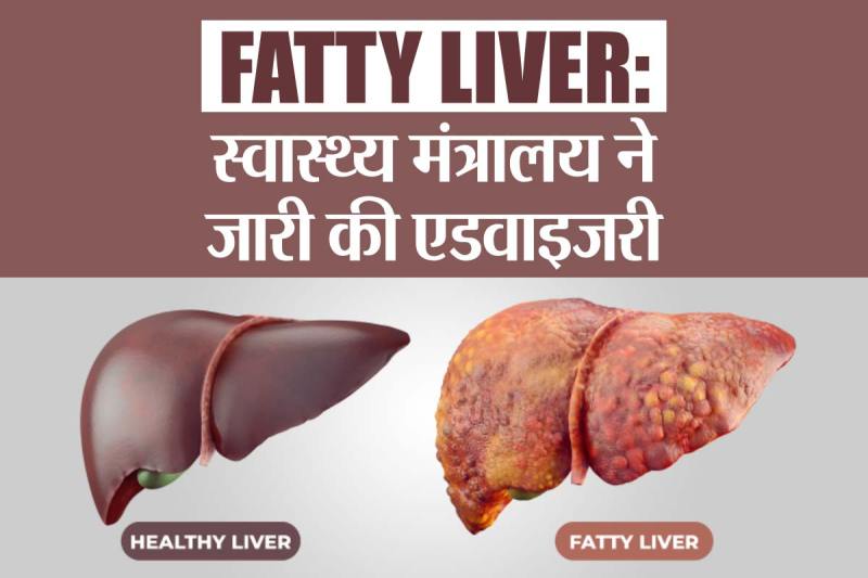 Fatty Liver