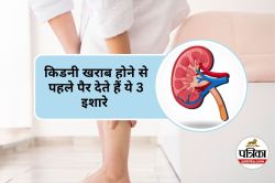 Foot Symptoms of Kidney Problems : किडनी की समस्या से पहले पैरों में दिखते हैं
ये 3 लक्षण - image