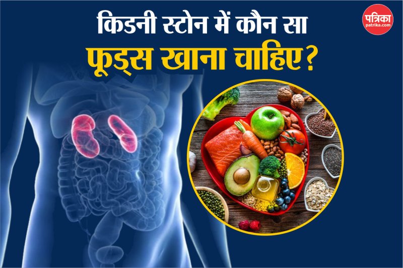 Good Food For Kidney Stones