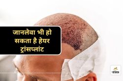 Hair Transplant Side Effects : हेयर ट्रांसप्लांट के दौरान इंजीनियर की मौत, जानिए
हेयर ट्रांसप्लांट के वो जोखिम जिनसे अनजान हैं आप - image