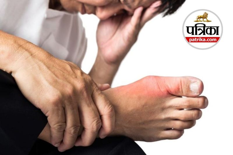 High Uric Acid Remedy