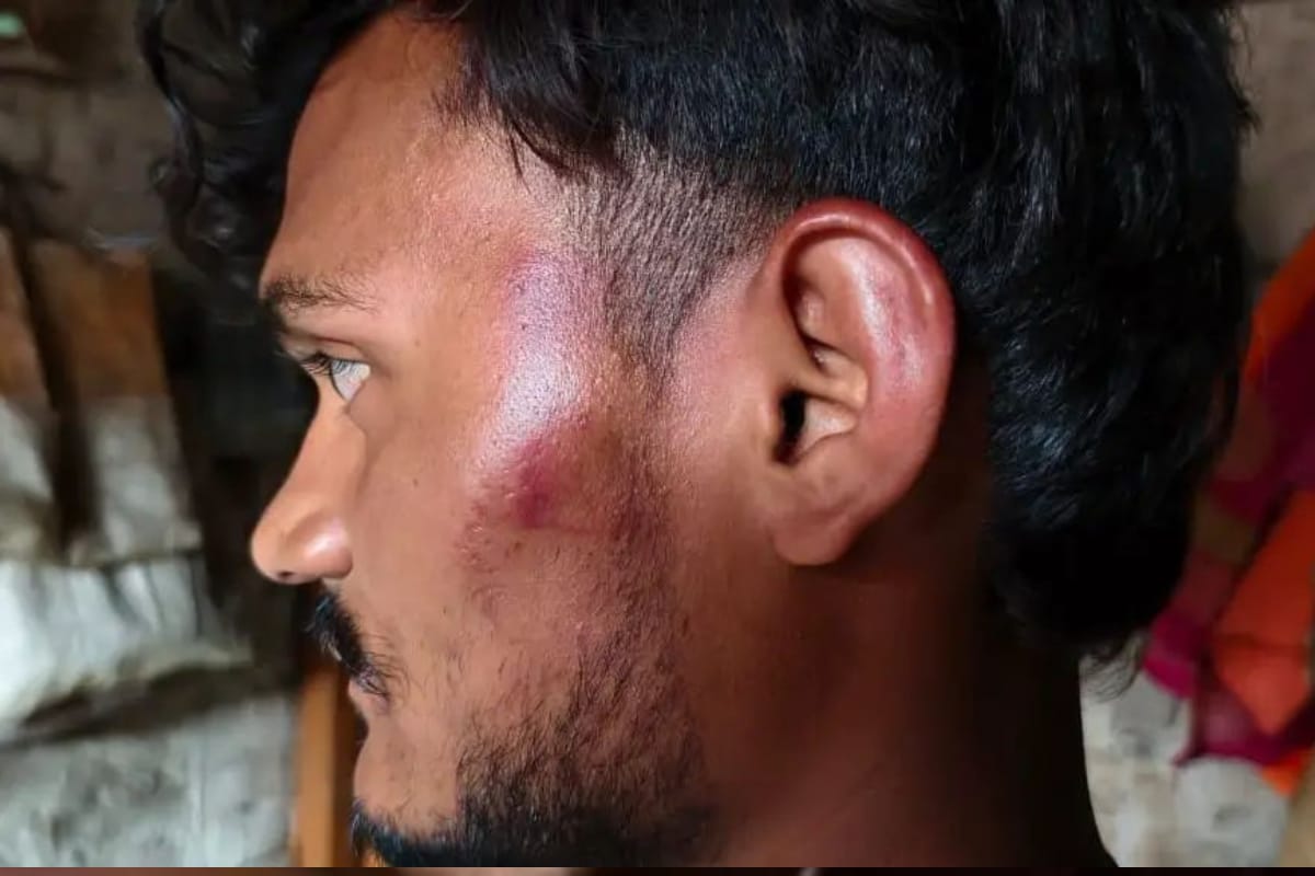 यूपी में “पाकिस्तान जिंदाबाद” न लिखने पर युवक को मनबढ़ों ने पीटा, धमकी देते हुए
फरार