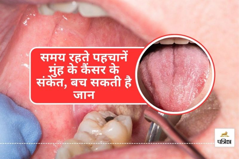 Oral Cancer Symptoms