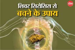 Prevention Of Liver Cirrhosis: लिवर सिरोसिस की बीमारी हो सकता है आपके लिए बेहद
खतरनाक!, जानिए इससे कैसे बचा जाएं - image