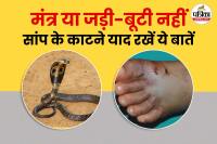 First aid For Snake Bites, Snake Bites Prevention, Sanp Ke Katne Par Kya Kare, Health Ministry Of India, Snake Bites Guidelines,