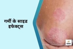 Summer Side Effects : गर्मी में पसीना और फंगल संक्रमण, बढ़ रही त्वचा संबंधी
समस्याएं - image