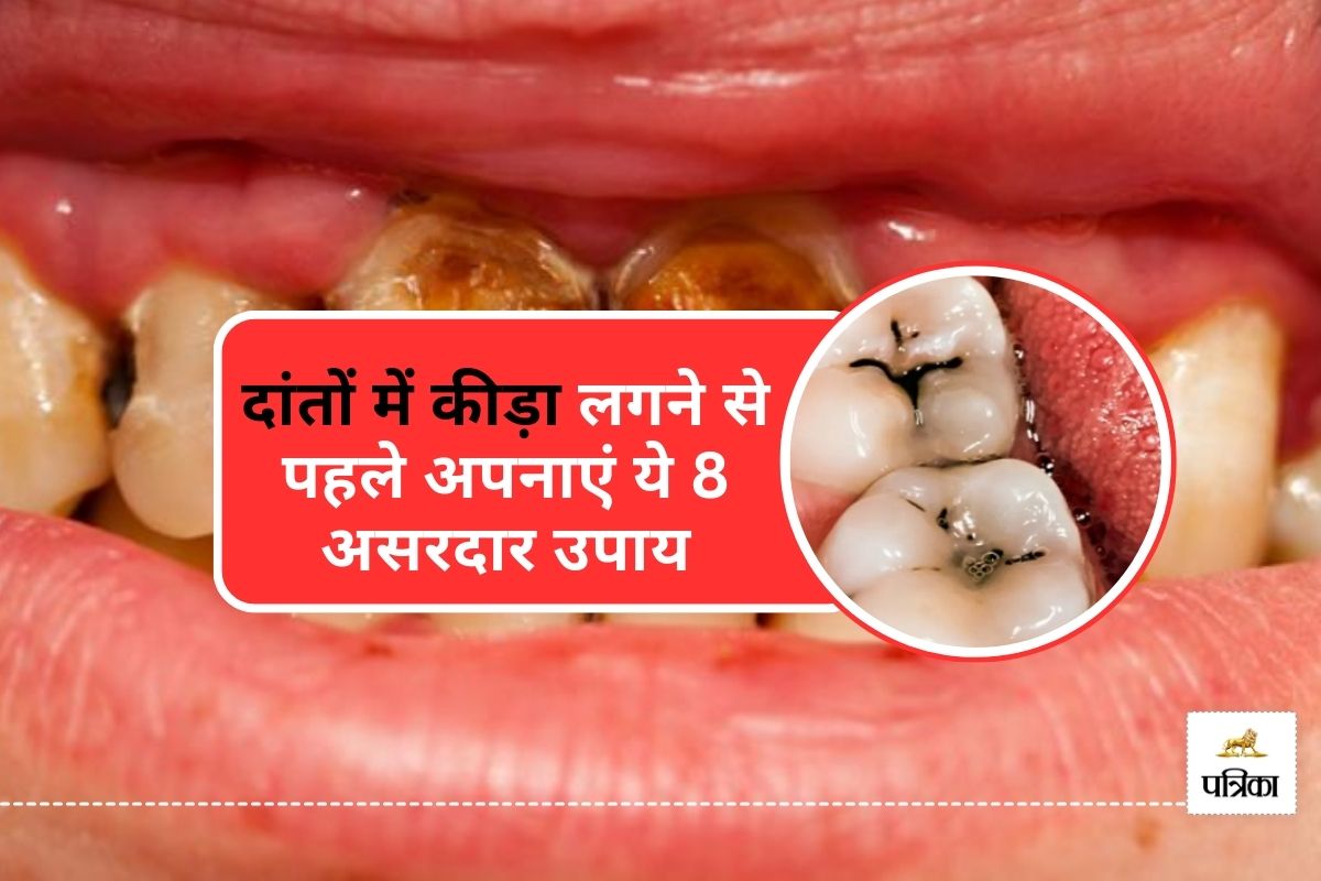 Cavity Remedies : दांतों में कीड़ा लगने से बचाएंगे ये 8 घरेलू तरीके
