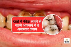 Cavity Remedies : दांतों में कीड़ा लगने से बचाएंगे ये 8 घरेलू तरीके - image