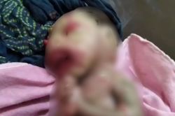 Video: राजस्थान में महिला ने दिया ऐसे बच्चे को जन्म, जिसे देखकर डॉक्टर भी रह गए
हैरान, बना चर्चा का विषय - image