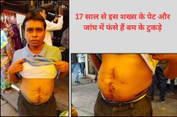 Jaipur: 17 साल से पेट और जांघ में बम के टुकड़े, न्याय और मदद के इंतजार में
देवीलाल… - image