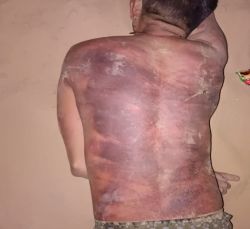 युवती से मिलने पहुंचे युवक को अर्द्धनग्न कर लाठी-बेल्ट से पीटा - image