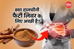 Cinnamon For Fatty Liver: फैटी लिवर को को ठीक करने में मददगार है दालचीनी, जानें
घरेलू नुस्खे जो कर सकते हैं कमाल - image