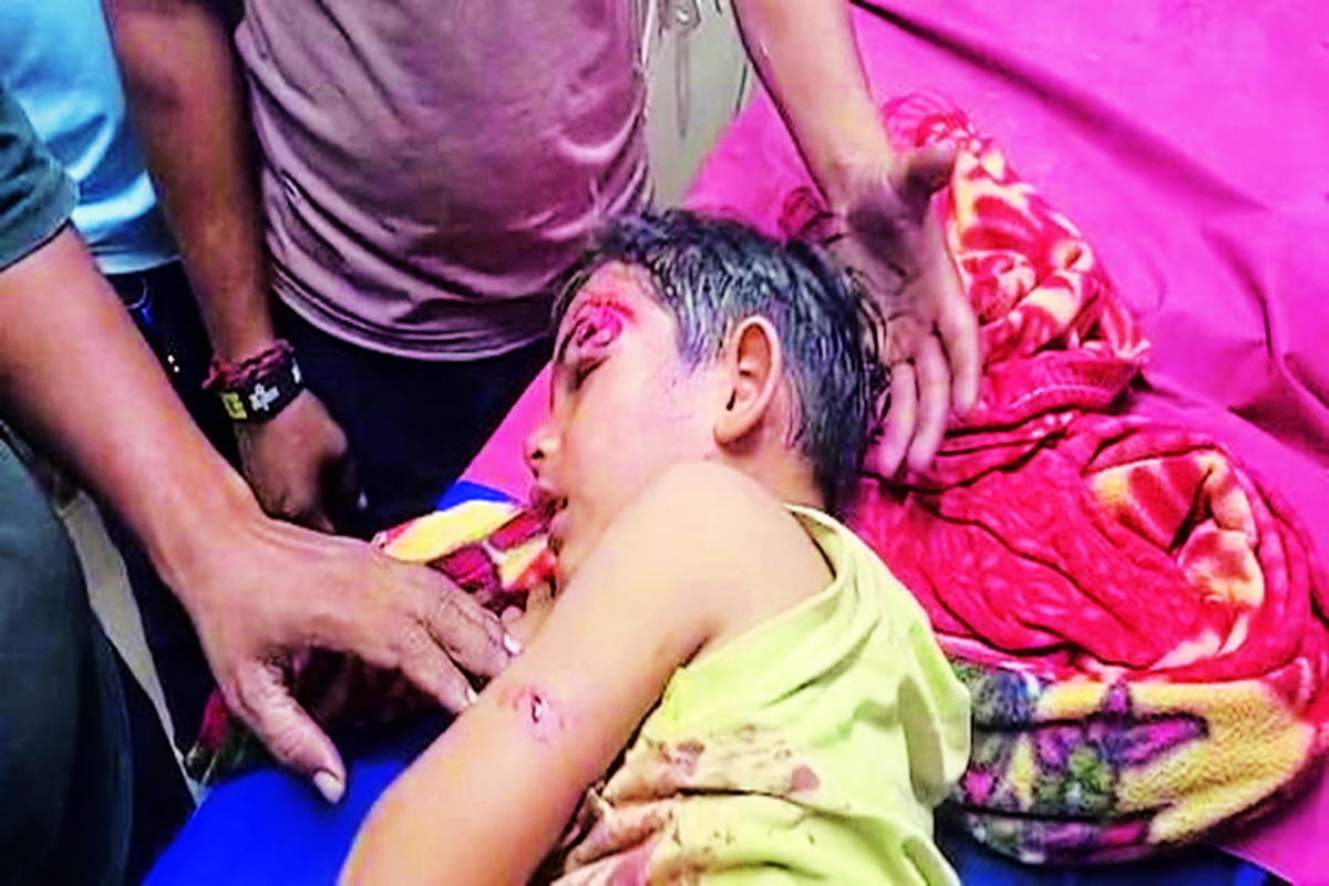 श्वानों ने मासूम सहित युवक को नोच डाला.. देखें फोटो गैलेरी….