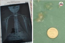 Child swallowed coin: खेल-खेल में बच्चे ने निगल लिया 5 रुपए का सिक्का, गले में
फंसने आफत में पड़ी जान, फिर डॉक्टर बने भगवान - image